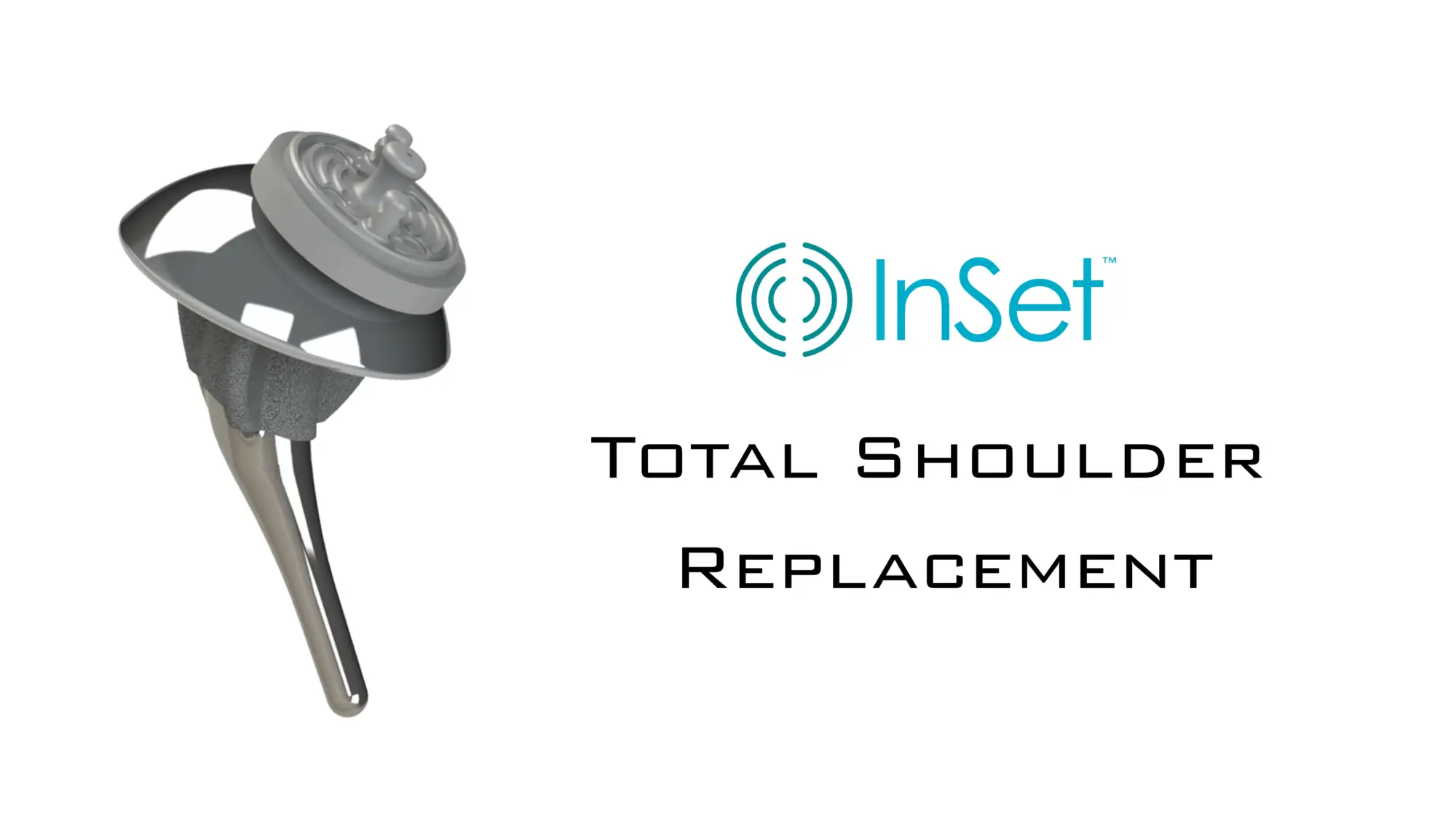 InSet™ Total Shoulder Implant