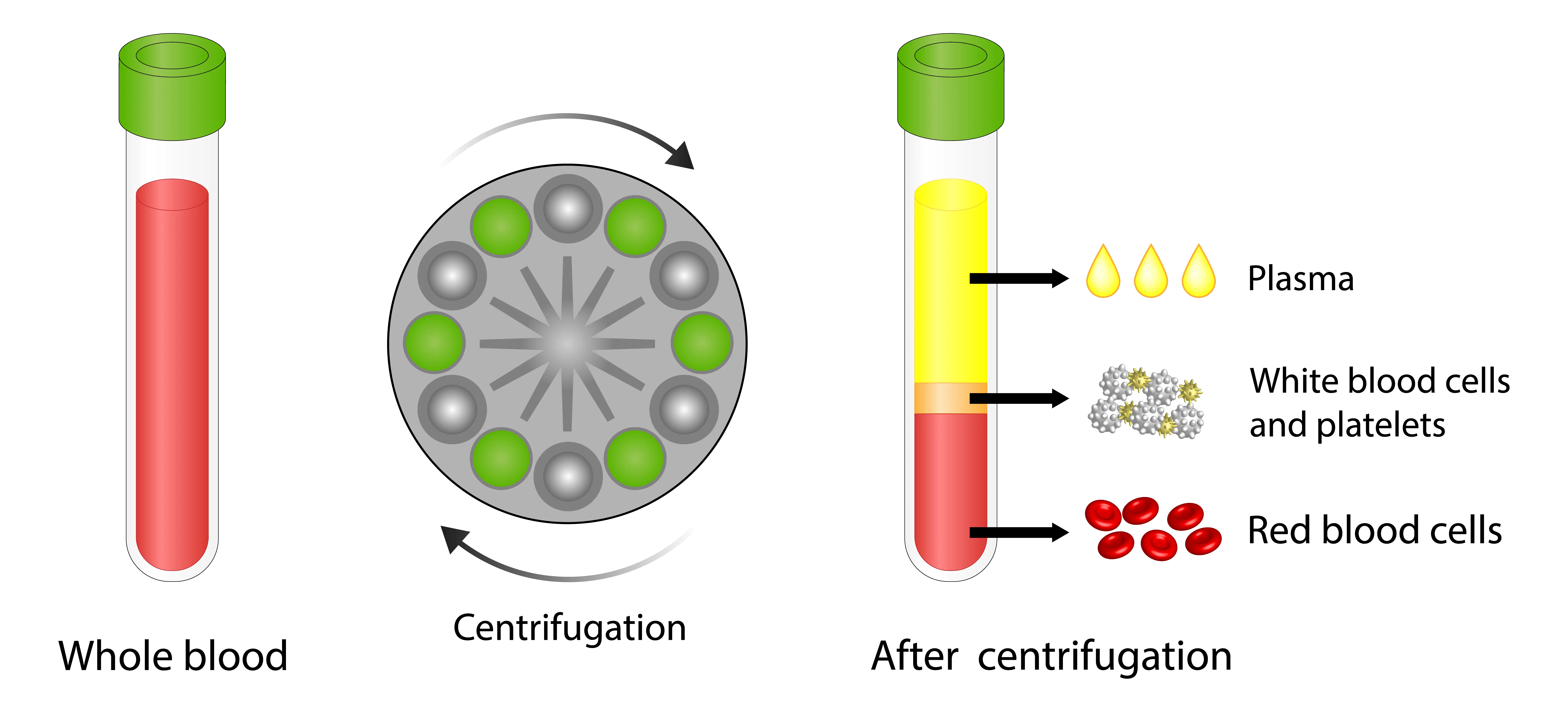 Anatomical Graphic of PRP 