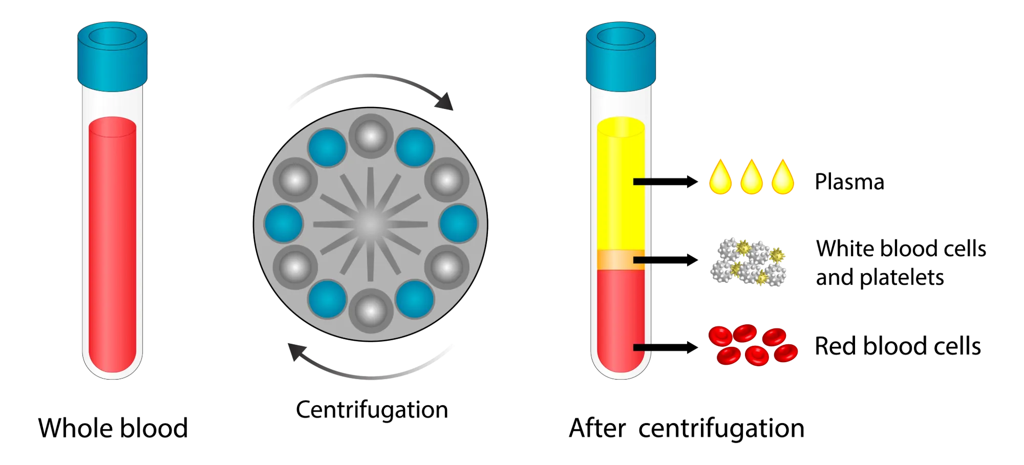 Anatomical Graphic of PRP