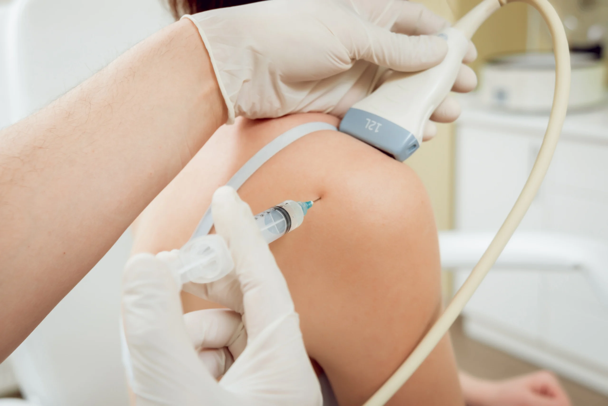 woman receiving PRP injection in her shoulder