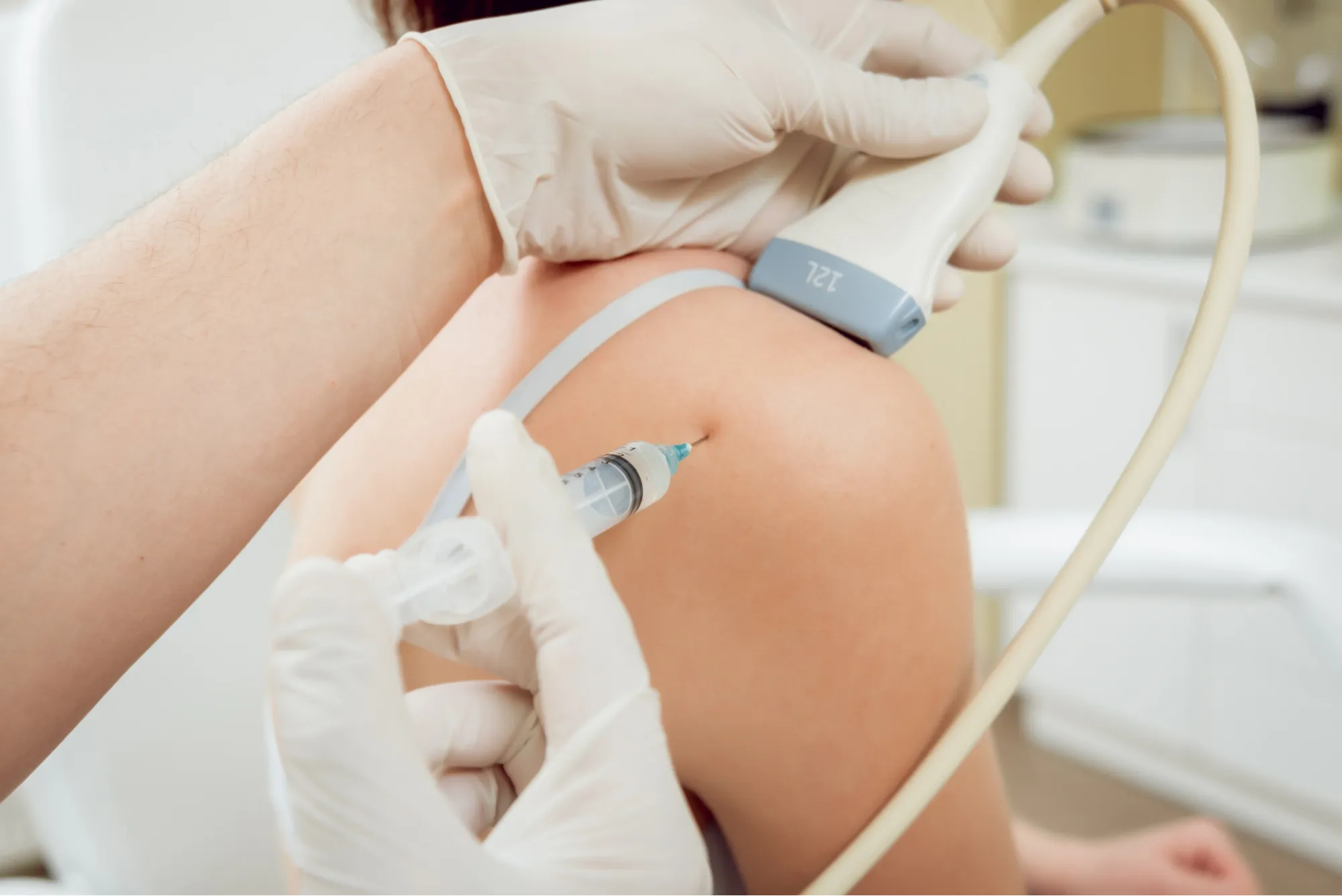 woman receiving PRP injection in her shoulder for injuries.
