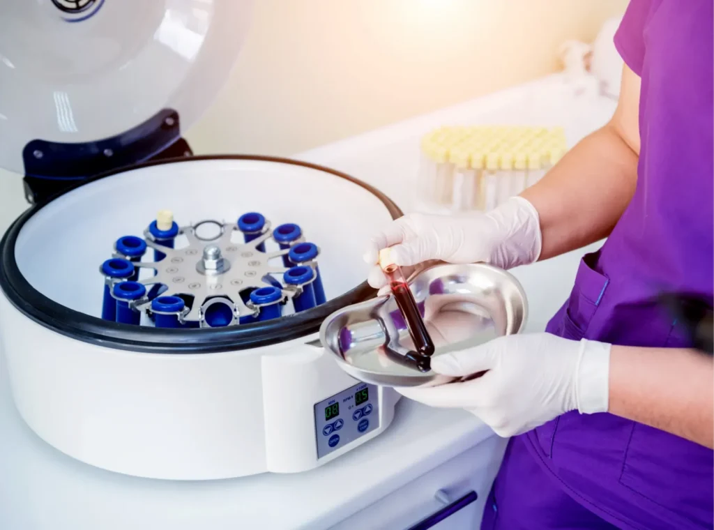 prp process surgeon involved in PRP centrifugation process.