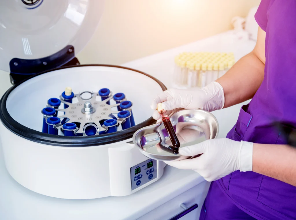 prp_process_1 surgeon involved in PRP centrifugation process.