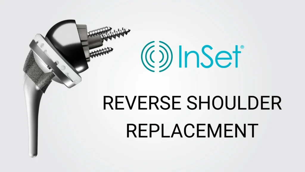 Implant Images RSA InSet™ Reverse Shoulder Implant