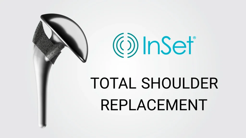 Implant Images TSA InSet™ Total Shoulder Implant